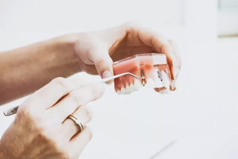 Quais os tipos de implante dentário?