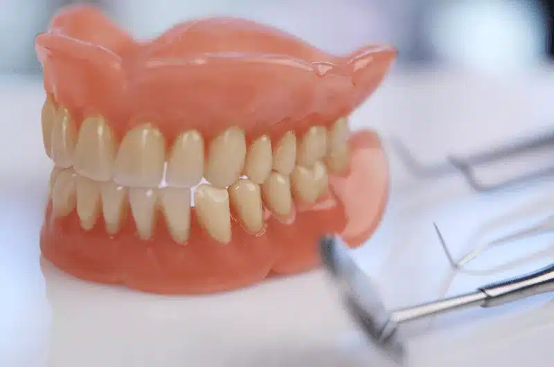quais os tipos de protese dentaria
