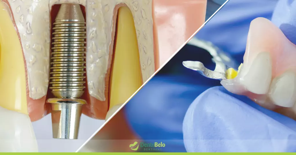 Quais as diferenças entre um implante e uma prótese dentária