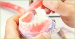 Banner prótese dentária - Diferença entre implante e prótese