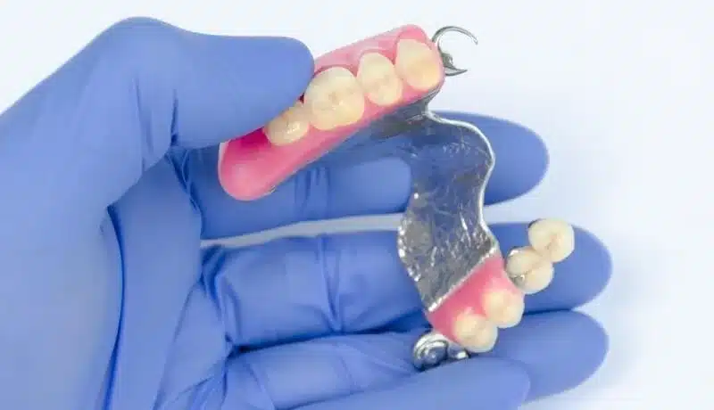 Prótese parcial removivel na dentebelo