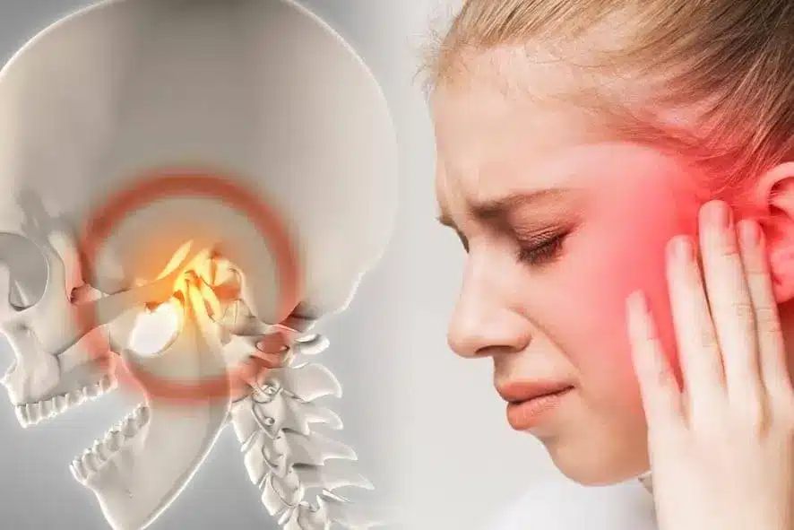 Odontoclínica Novo Hamburgo - A articulação temporomandibular (ATM) funciona  como uma dobradiça que liga o maxilar ao crânio. Esta disfunção pode causar  dor e desconforto. Dores no maxilar, dificuldade de mastigar e