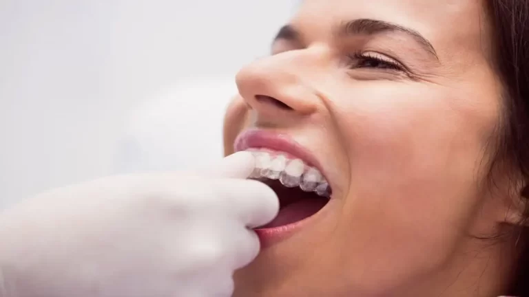 Dentaduras ou Pontes: tudo o que você precisa saber sobre o assunto!