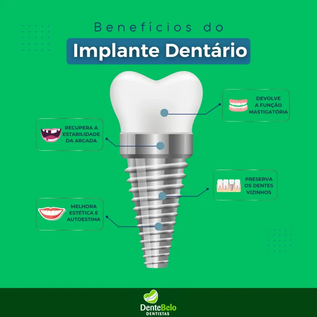Implante dentário benefícios